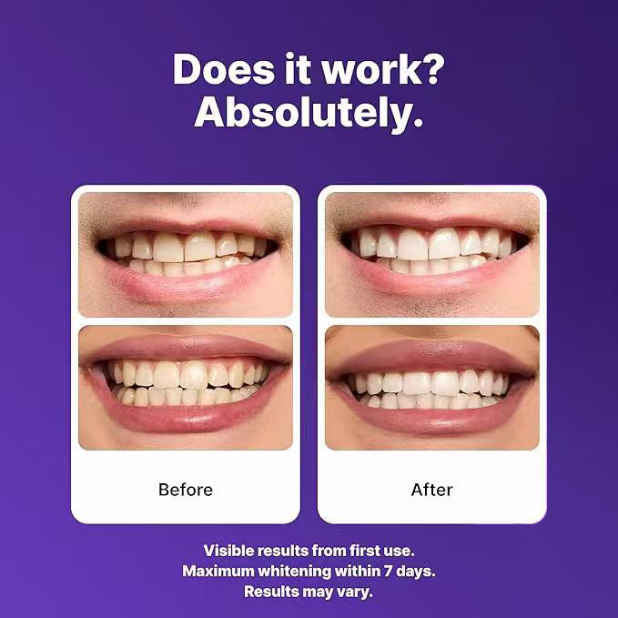 Juxek™ New 2nd Generation Purple Teeth Whitening Strips