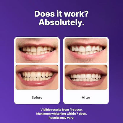Juxek™ New 2nd Generation Purple Teeth Whitening Strips