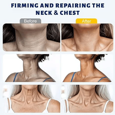 ✨ Tiworld™ Instant Neck Lift Cream  — 🧴 Infused with Retinol & Hyaluronic Acid | Firms the Neck, Reduces Wrinkles & Double Chin（2）